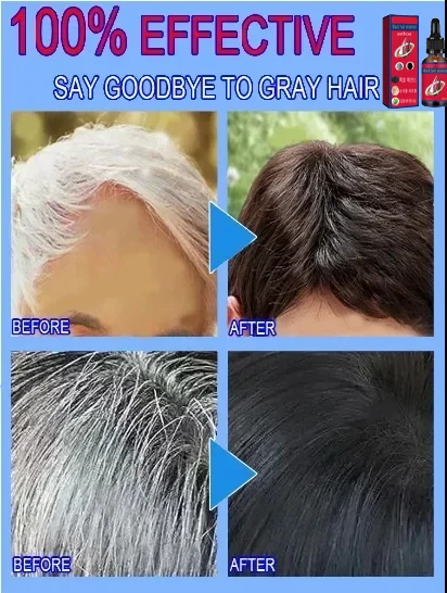 White hair killer remove gray hair and restore natural color in 7 days hair coloring product
