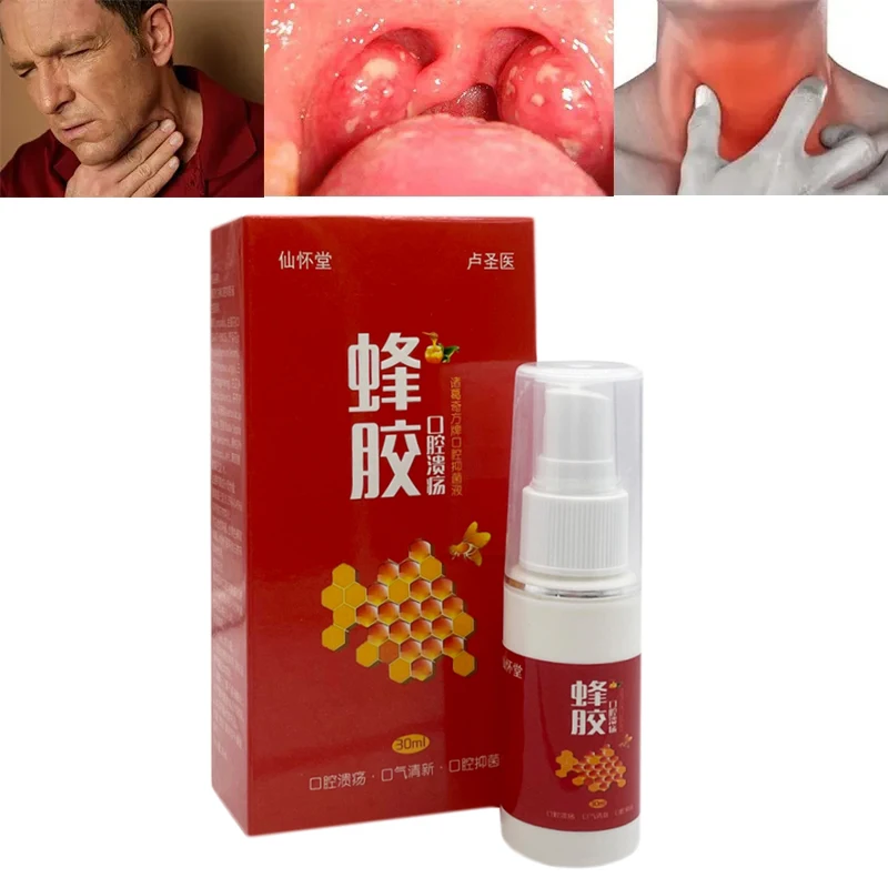 

30ML Propolis Mouth Clean Oral Spray Mouth Treatments Of Oral Ulcer Pharyngitis Halitosis Throat Cool And Fresh Oral Cure