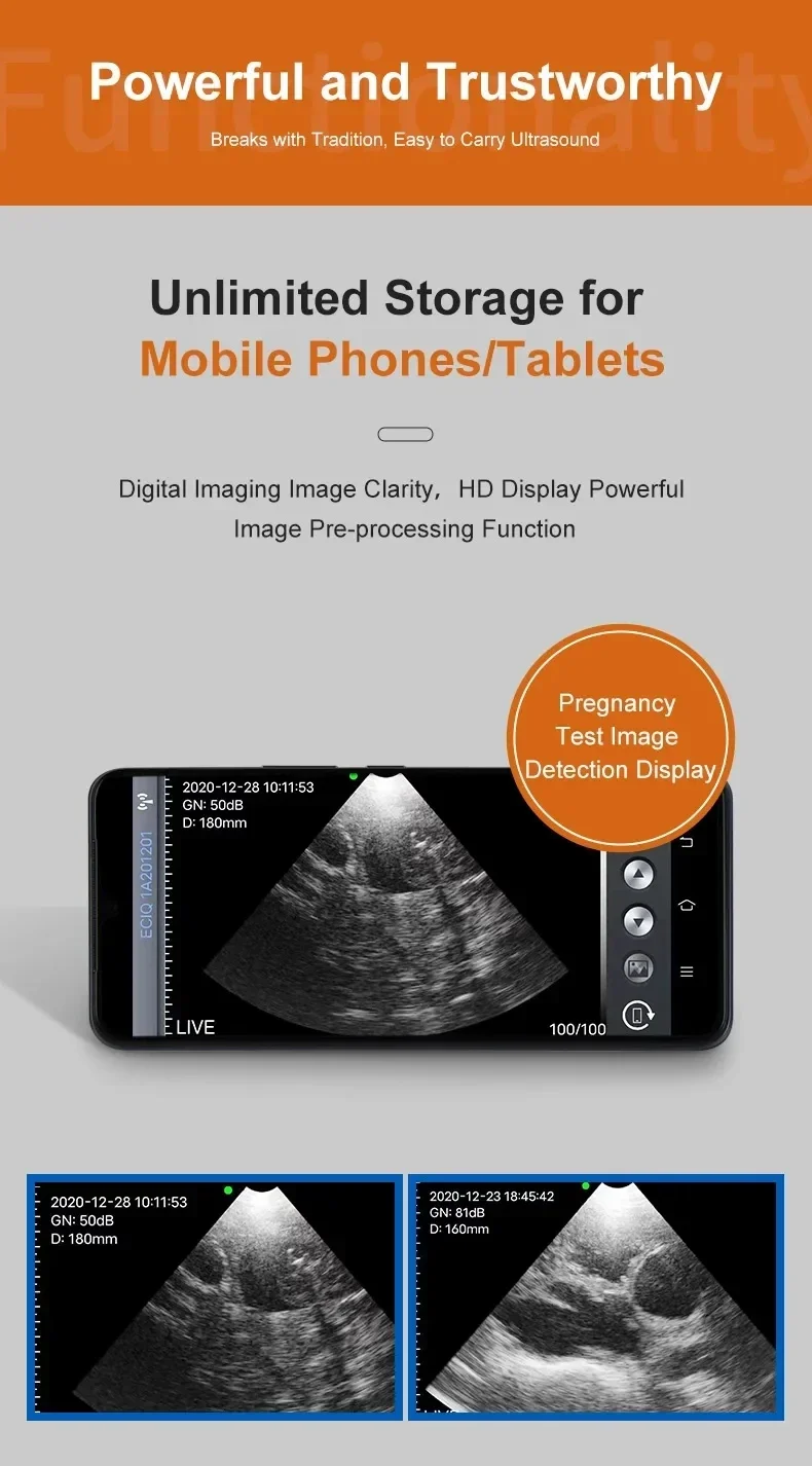 Veterinary Ultrasound Scanner Animal Wireless Ultrasound Probe Machine Handheld