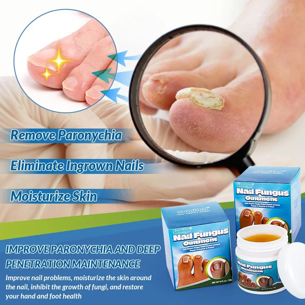 Nail Fungus Remover Treatment Cream Anti Infection Onychomycosis Paronychia Repair Gel Toe Nail Fungal Removal Hand Foot Care Products