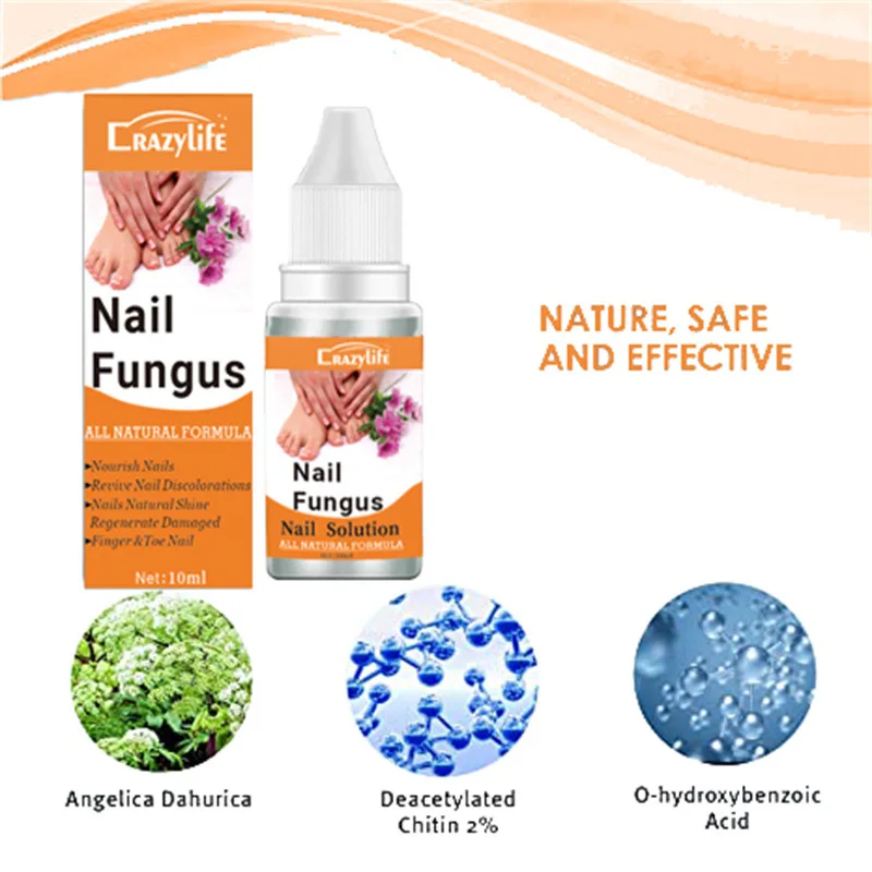 Arishine Fungus Treatment, Fungus Stop, Anti Fungus Nail Treatment,  Effective Against Nail Fungus, Anti Fungal Nail Solution, Beauty & Personal  Care, Hands & Nails on Carousell