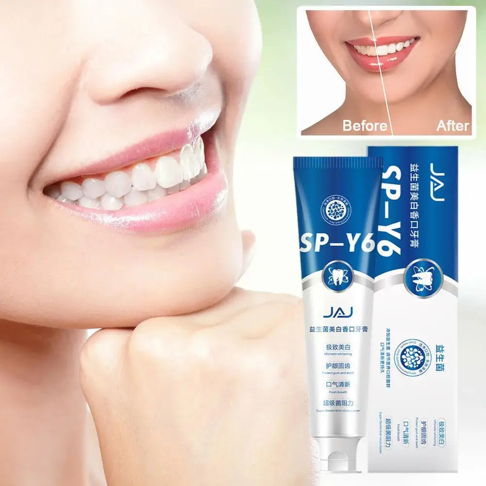 

100g Probiotic Whitening Shark Toothpaste Teeth Whitening Fresh Oral Breath Toothpaste Care Plaque Prevents Toothpaste Z0F2
