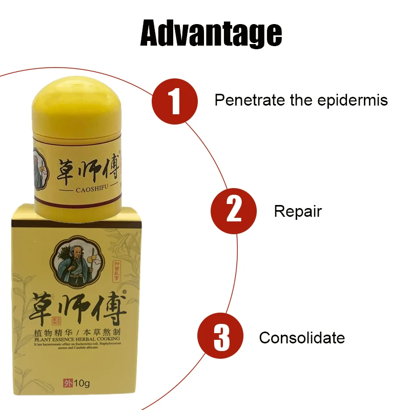 Natural Psoriasis Ointment Treat Dermatitis Eczema Antipruritic Dressing Eczematoid Skin Repair Antibacterial Cream 4pcs 10g