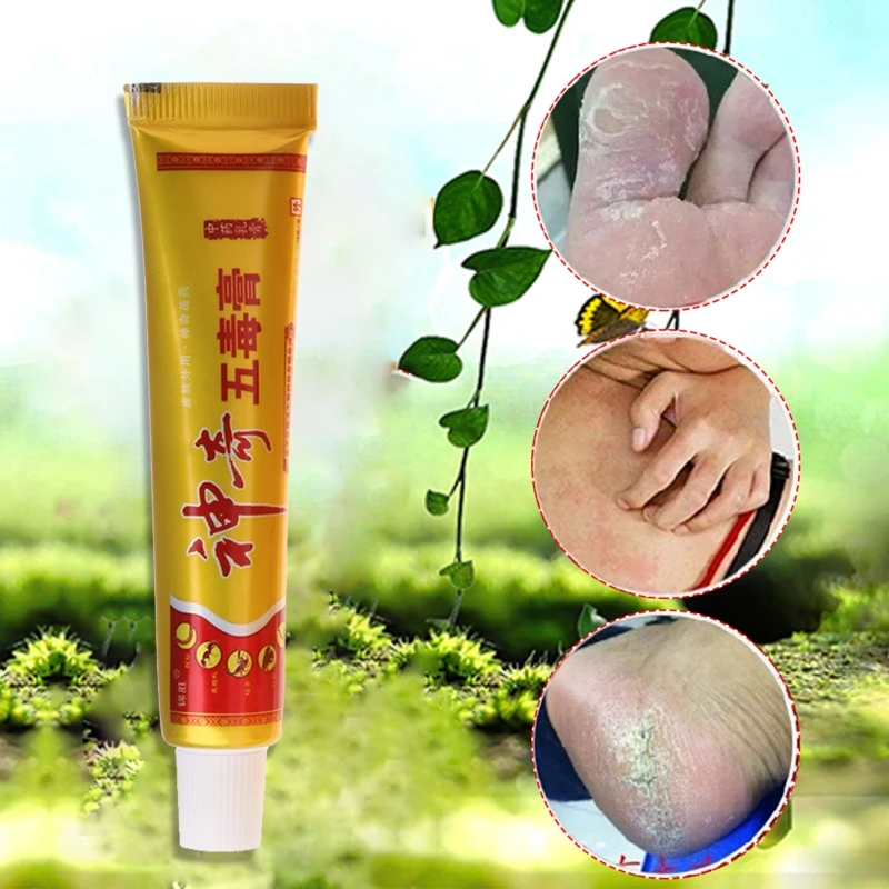 

Body Psoriasis Dermatitis Eczema Skin Problems Chinese Herbal Cream Ointment New