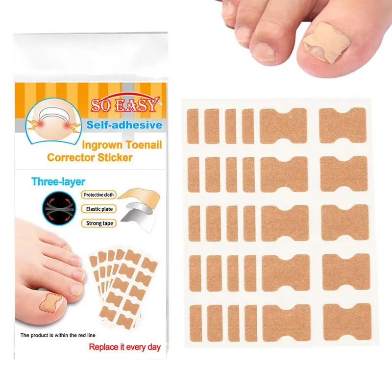 

Toenail Corrector Strips Health Toenail Corrector Patch Ingrown Toenail Tool 50 Pieces Professional Toenail Correction Pedicure
