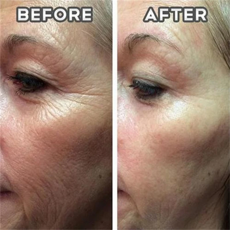 90 Caps Hydrolyzed Collagen Capsules,Remove Spots Wrinkle Eye Bags, Anti-Aging,NAD+ Supplement,Skin Care Repair for Women
