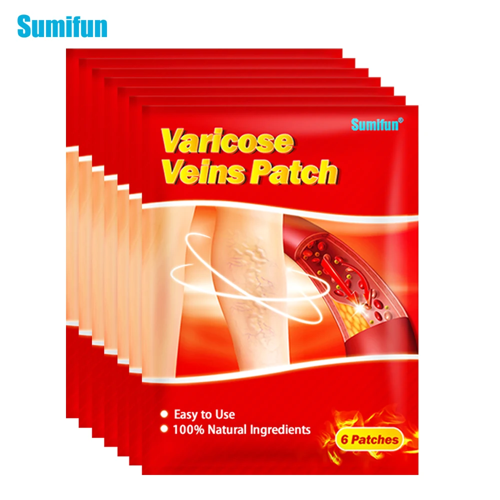 

60Pcs Sumifun Hot Varicose Veins Patches Varicosity Angiitis Leg Spider Removal Sticker Vasculitis Phlebitis Pain Relief Plaster