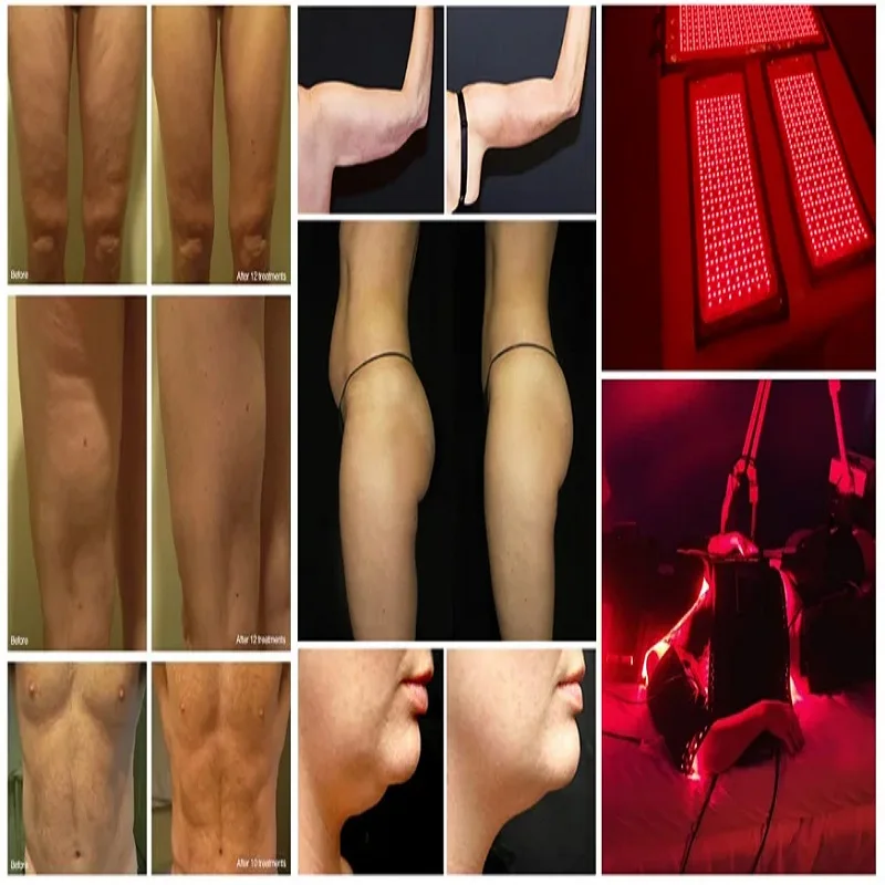 full body red infrared laser light light therapy Tanning Bed Led Red Light Therapy For Beauty Salon Whitening Cabin