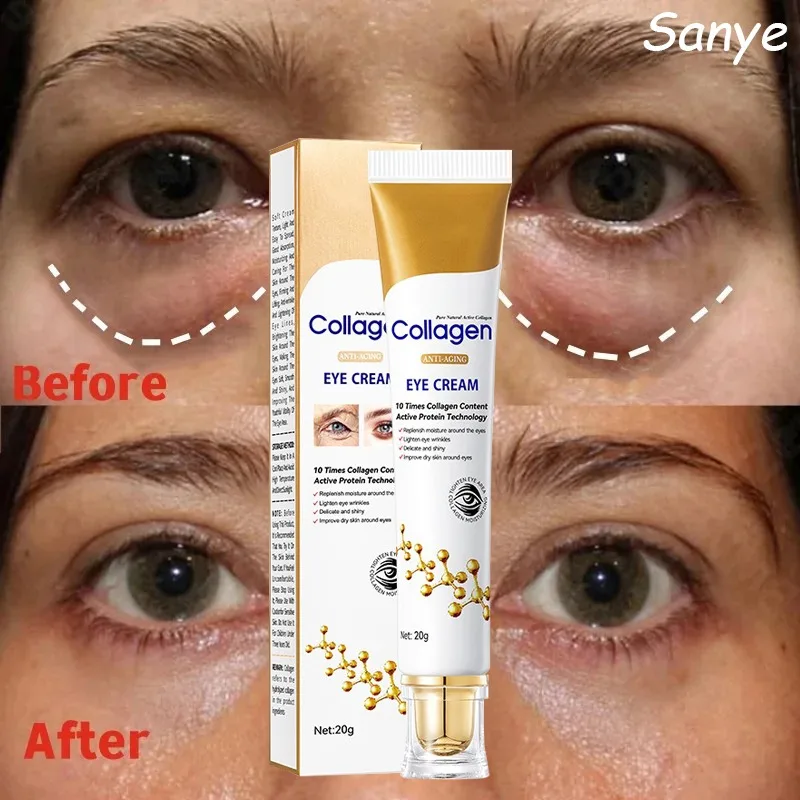 

Instant Eye Bag Removal Cream Fade Melanin Fine Lines Lifting Skin Collagen Eyes Serum Brighten Dark Circle Anti Puffiness 2024