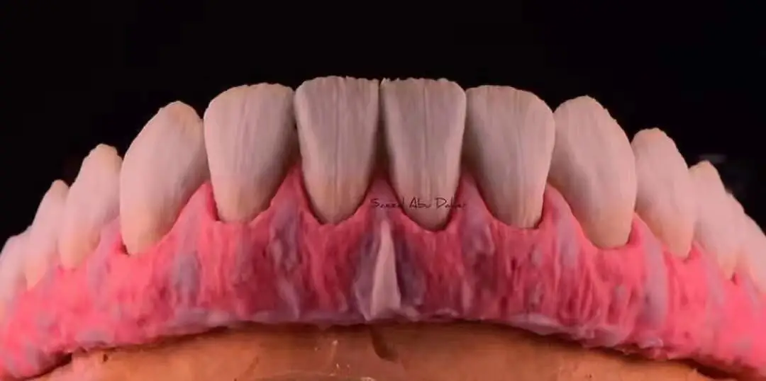 Polvo de porcelana para glaseado de dientes dentales, líquido de esmalte de 100ml, uso en técnico de laboratorio Dental, 50g, 1 botella
