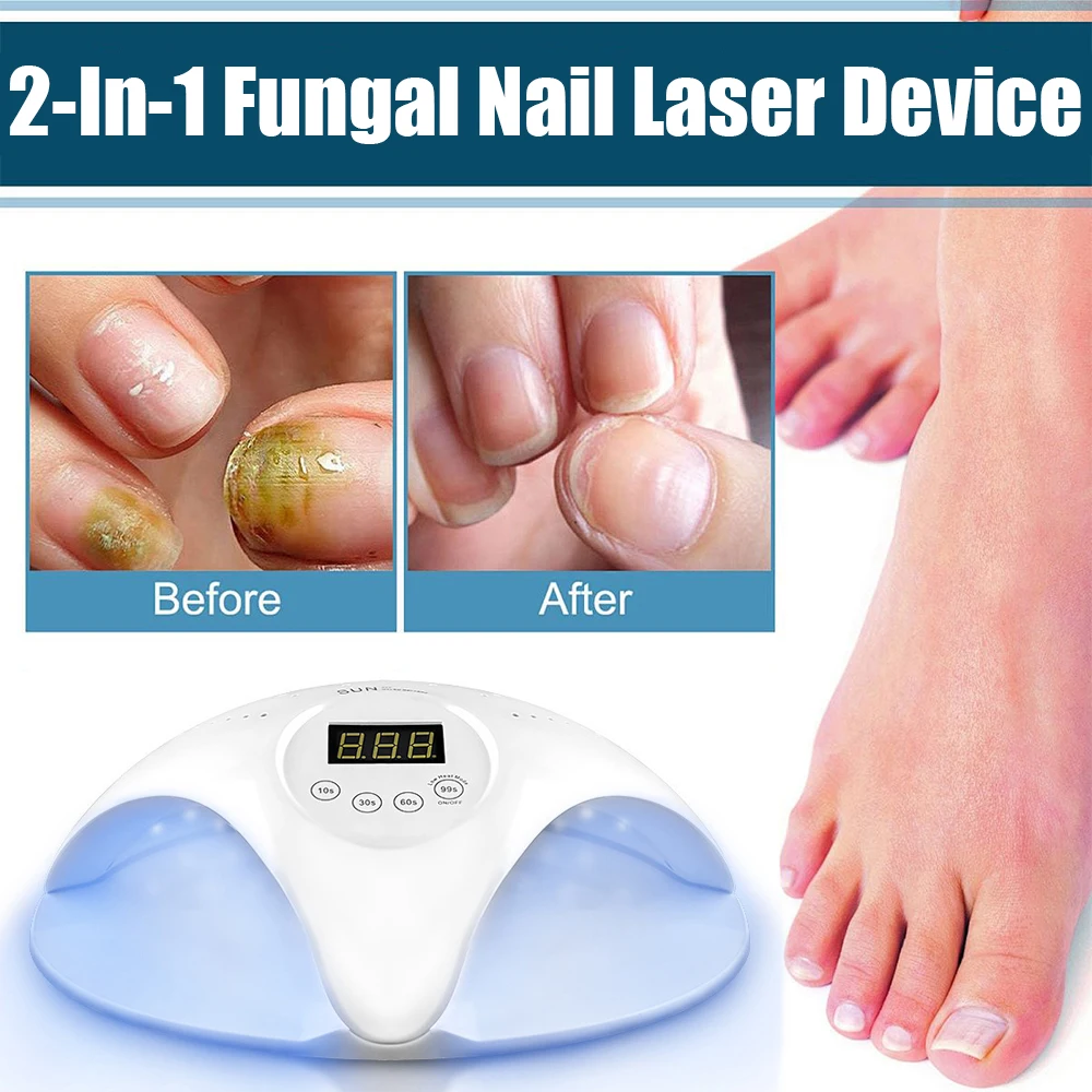 2-In-1 Fungal Nail Laser Device Repair Fast Nails Fungus Onychomycosis Repair Toenail Fingernail Removes Nail Fungus Foot Care nail fungus remover,laser therapy pen