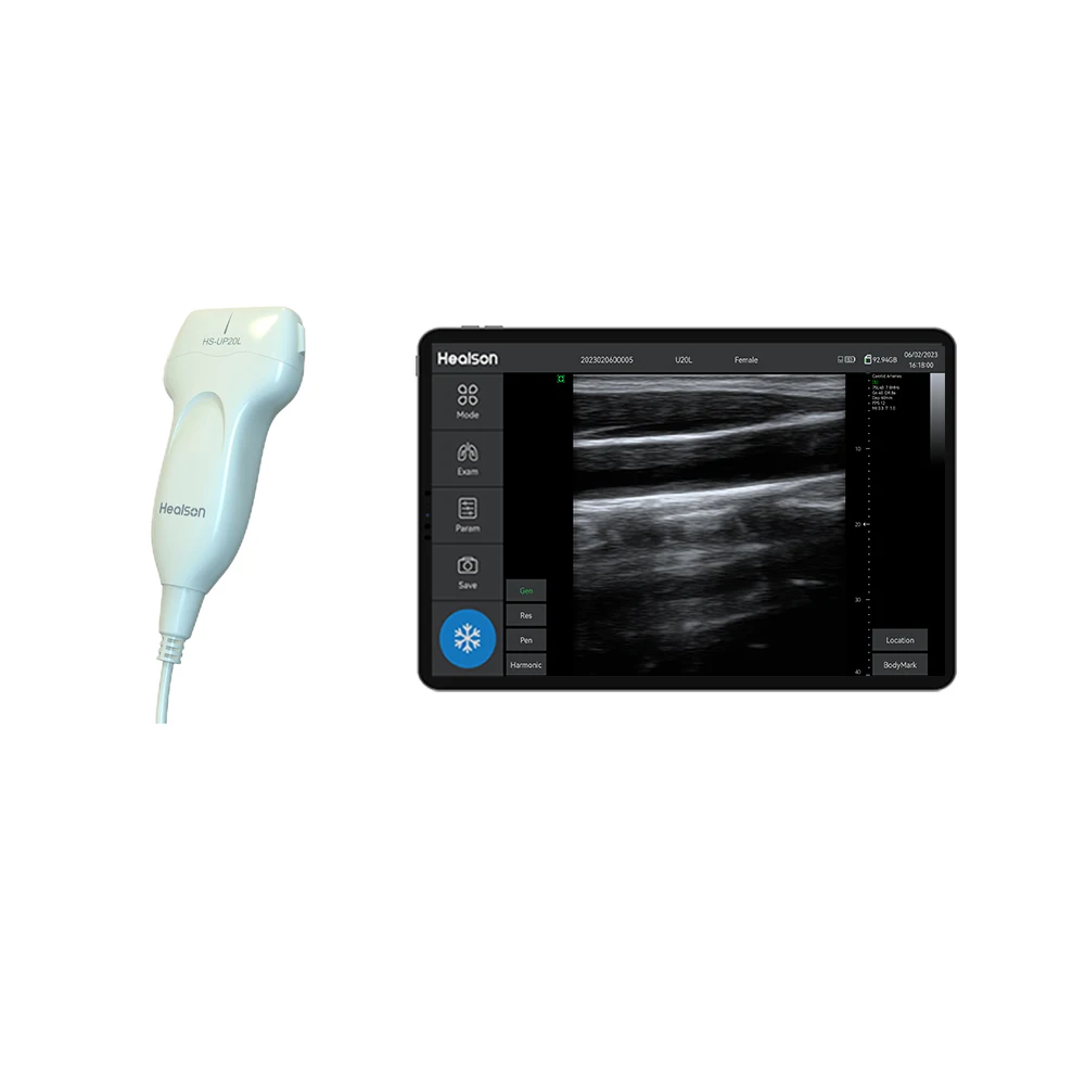 Portable B/W Handheld Linear Scanner Ultrasound Probe Medical Instruments with Android Tablet Computer