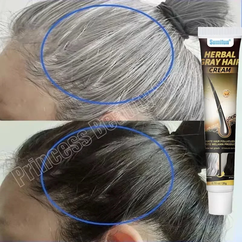 Hair Treatment Oil Hair Treatment Scalp Treatment for Anti-grey Hair