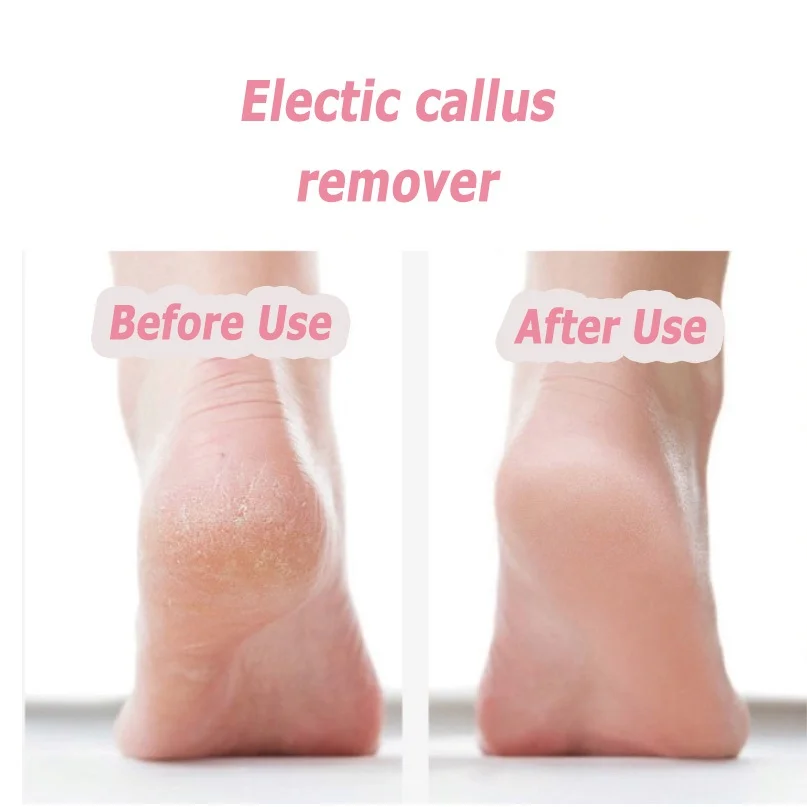 Portable Electric Foot Heel Care Tool Tool Feet Heels Skin Remover Cuticle File Set USB Pedicure For Men Women_voghion.com