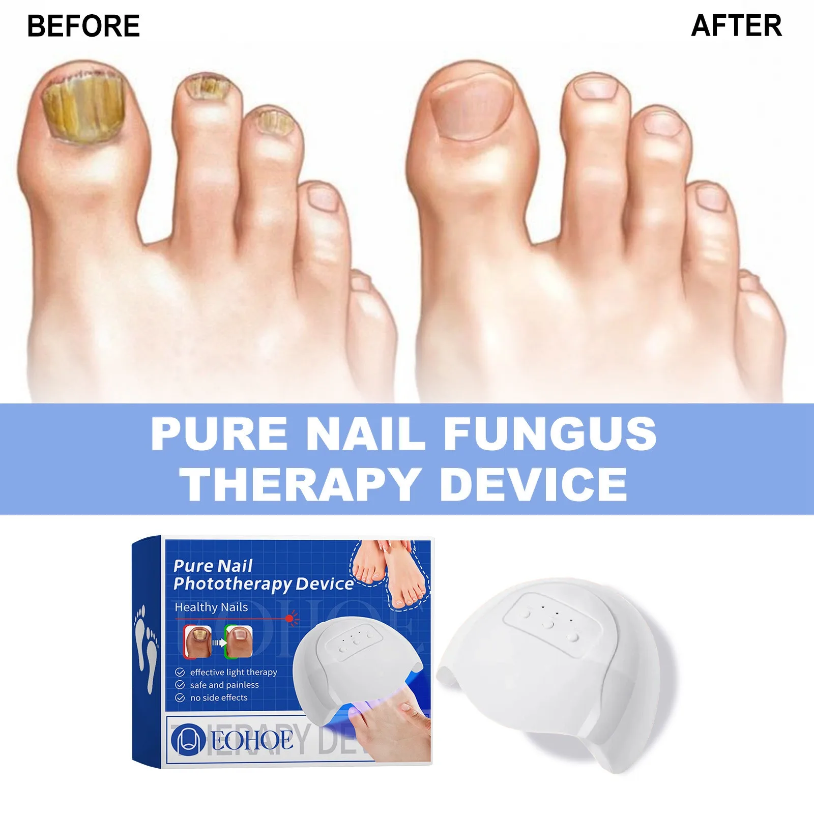 Fungal Nail Laser Device Repair Fast Nails Fungus Onychomycosis Repair Toenail Fingernail Removes Nail Fungus Foot Care Device nail fungus repair device