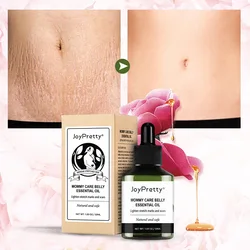 Fades PostpartumObesity AndStretch Marks Repair Essential Oils for Pregnant Womens Tummy Lines EssentialOilsBelly Firming Cream