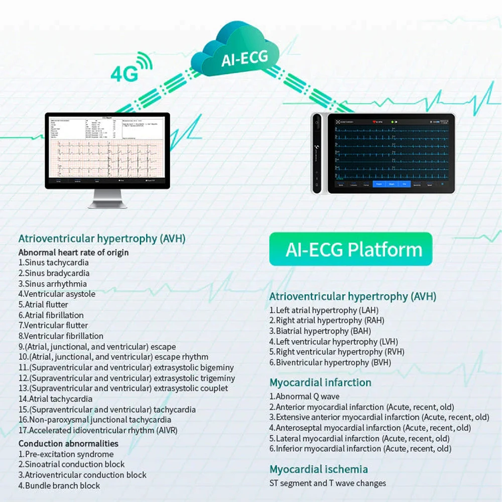 Touch Screen 12 Lead ECG Monitor Tablet Ai Analysis Diagnostic WiFi Wireless Transmission for Clinics Hospitals