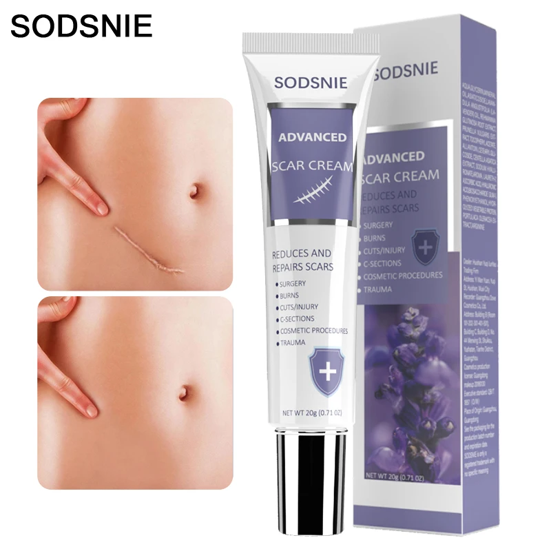 

Rapid Scar Removal Cream Effective Treatment Stretch Marks Burns Lighten Acne Spots Section Scars Whiten Skin Care Products