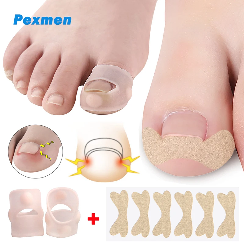 Pexmen 8Pcs Ingrown Toenail Corrector and Sticker Big Toe Nail Healing Care Protector Paronychia Treatment Pedicure Tool tumbeelluwa 1set 8pcs chakra healing crystals heart love carved palm worry stones reiki meditation balancing home decor 1 1