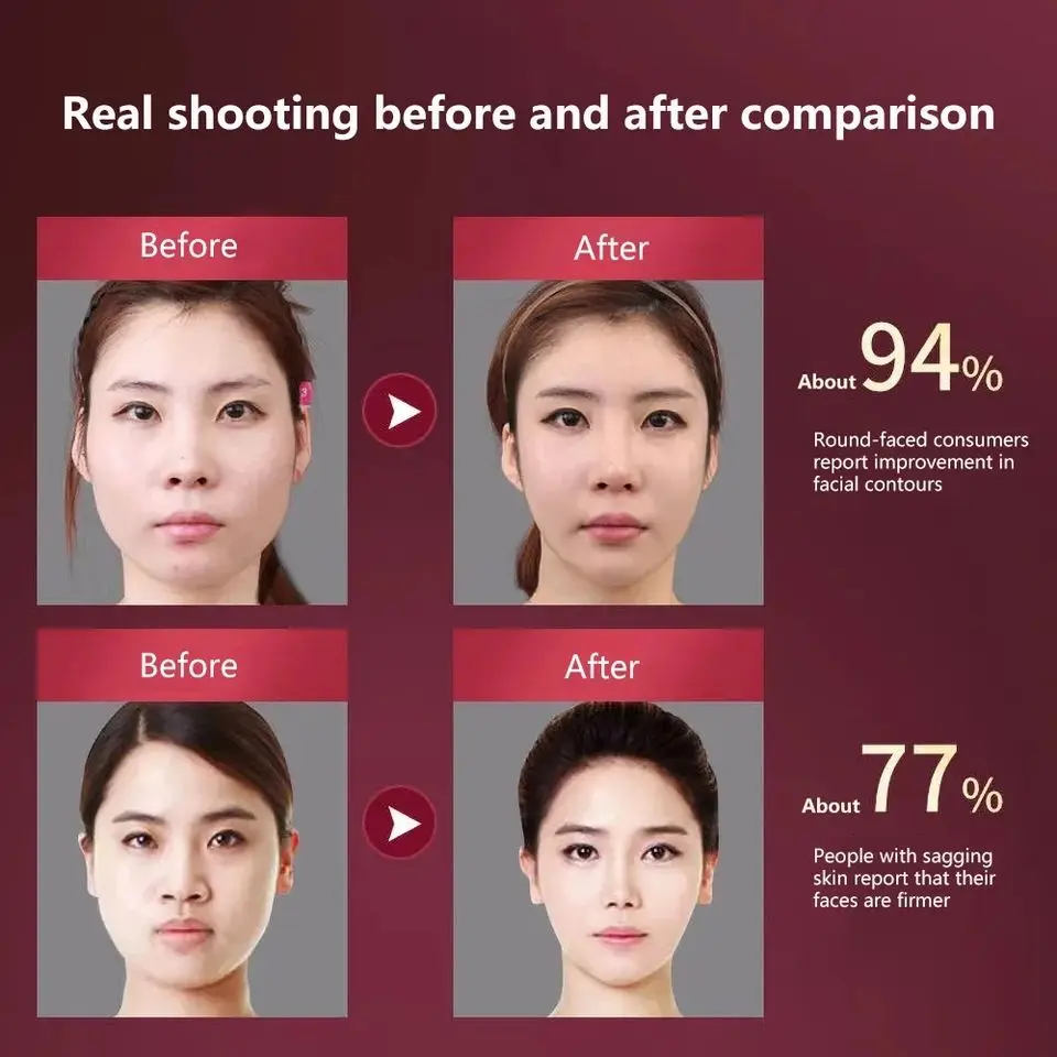 Facial Lifting Massager 12 Gears Electric Facial Massager V-line Face Lifting Slimming Vibration Device Home Use Beauty Tool 3