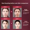 Facial Lifting Massager 12 Gears Electric Facial Massager V-line Face Lifting Slimming Vibration Device Home Use Beauty Tool 3