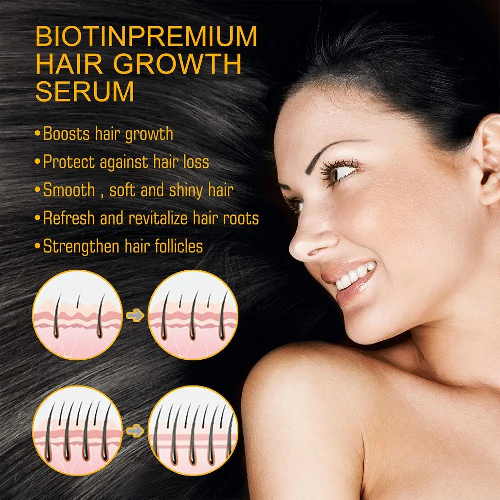 Biotin Spray &ndash; Essential Oils for Fast Anti-Hair Loss Scalp Treatment 30ml for Men and Women 2pcs