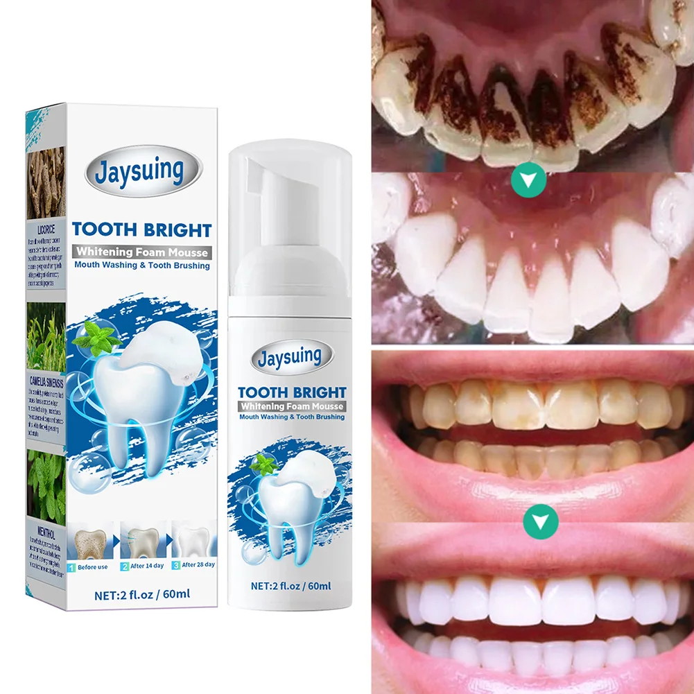 60ml Tooth Whitening Mousse Toothpaste Stains Plaque Removal Teeth ...