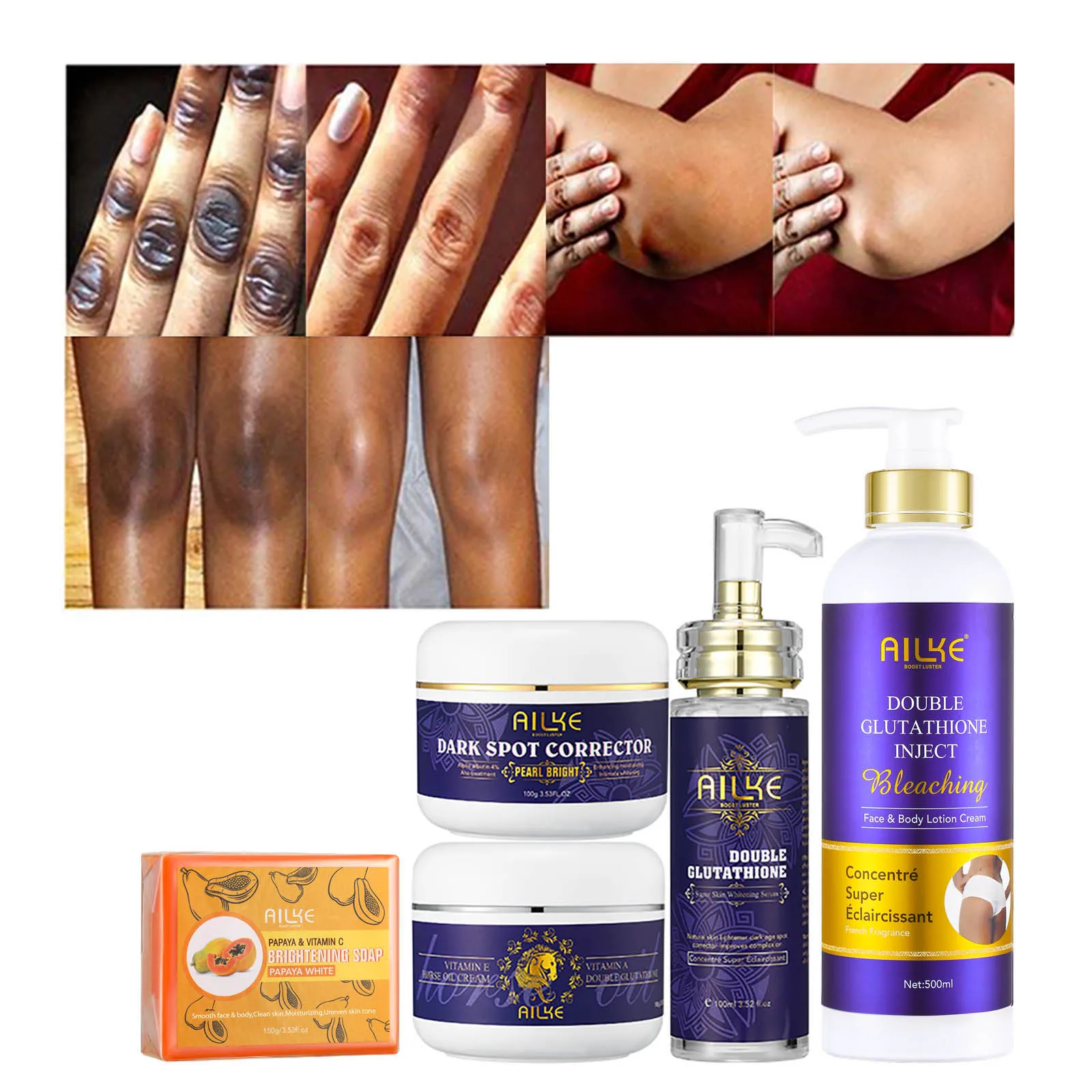 AILKE Super Bleaching And Dark Spot Remove Body Lotion Suitable For Face And Body Women Whitening Moisturizing Skin Care Cream 5