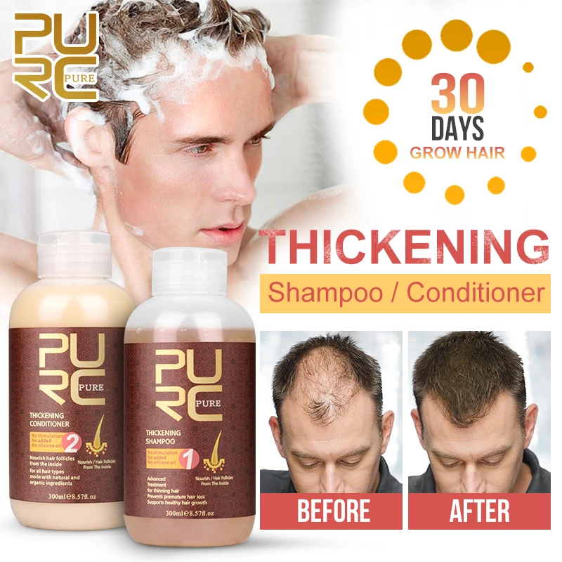 Purc Hair Growth Shampoo And Conditioner Set For Women Men Hair Loss  Products Prevents Scalp Thinning Treatments Hair Care 600ml - Hair Loss  Product Series - AliExpress