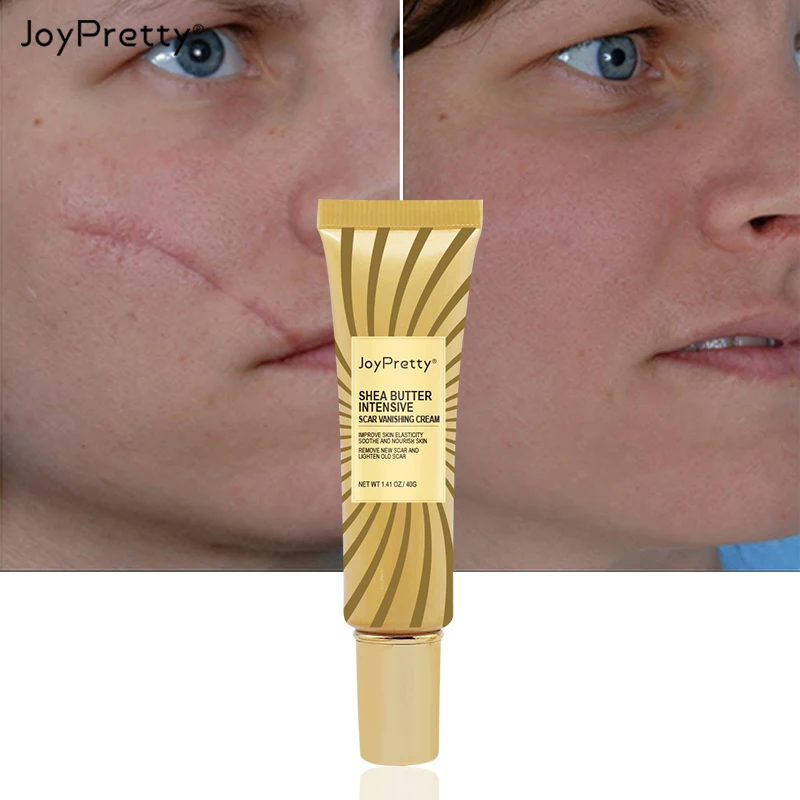 Joypretty 40g Scar Treatment Acne Pimple Mark Remover Cream Burn Scars