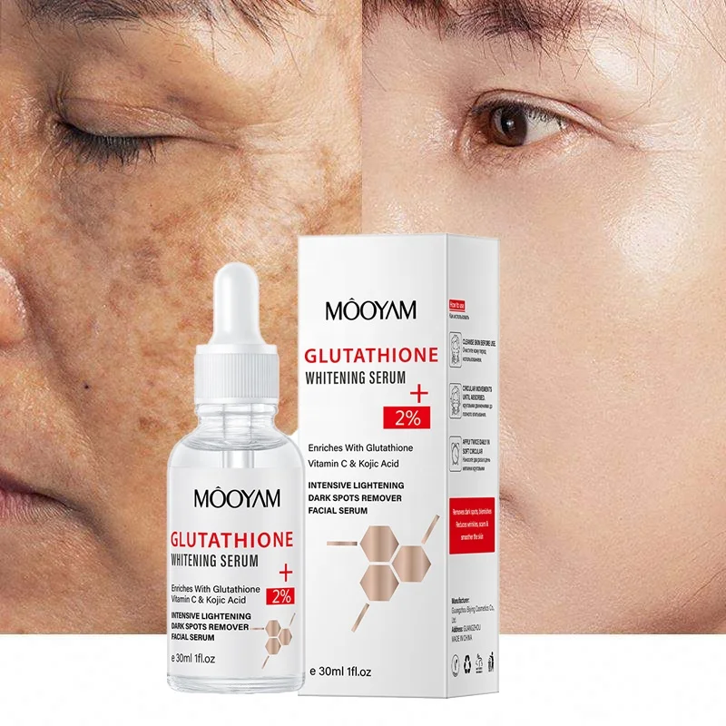 Glutathione Whitening Freckle Serum Remove Melasma Dark Spot Face Whitening Serum with Vitamin C Kojic Acid Moisturizing Essence ollin care restore serum with flax seeds сыворотка восстанавливающая с экстрактом семян льна 150 мл