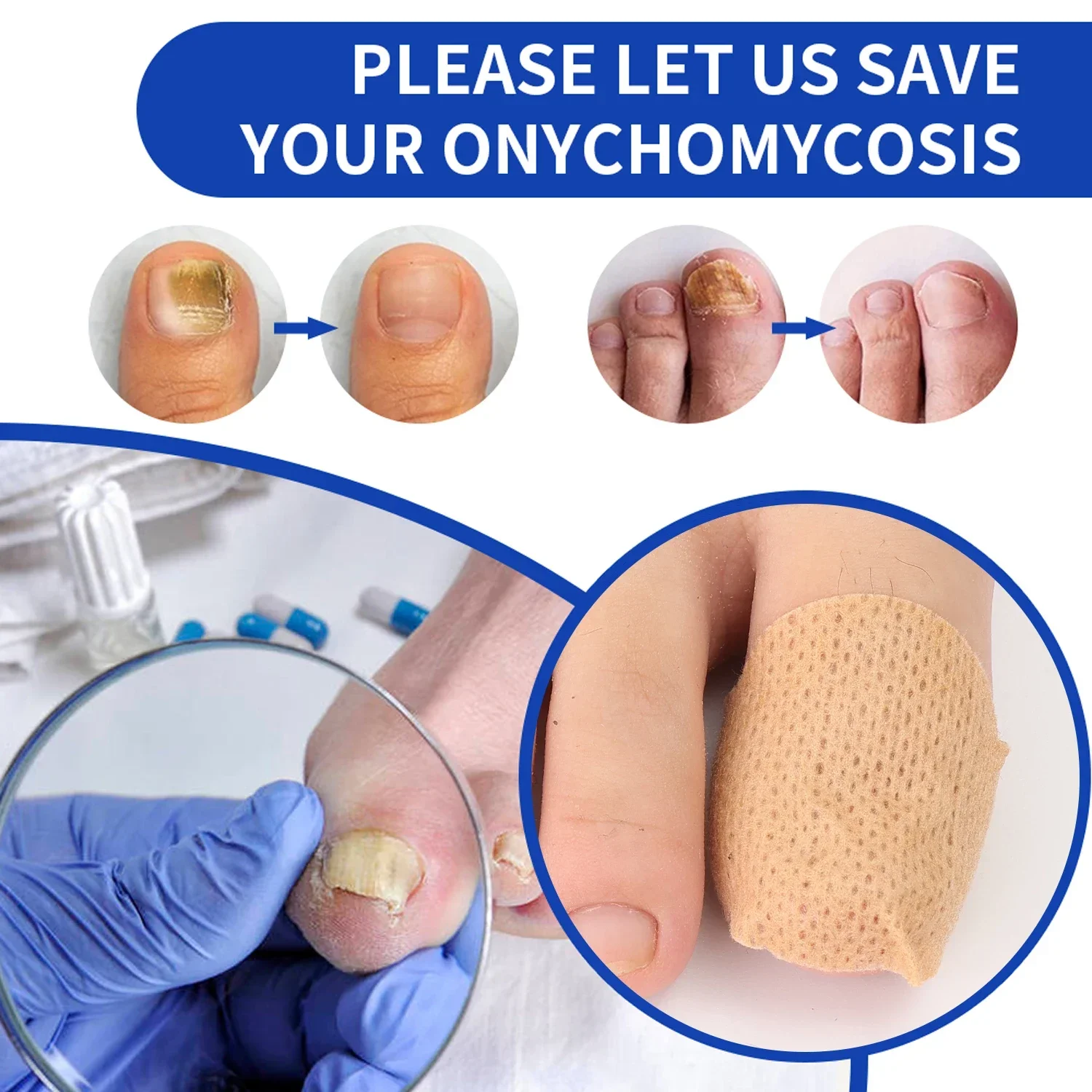 21pcs Waterproof Fungus Patch Ingrown Toenail Correction Sticker Damaged Gray Nail Repair Care Feet Tools_voghion.com