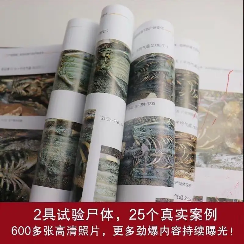 Рисунок 4 - Атлас автопсии, кадаверические