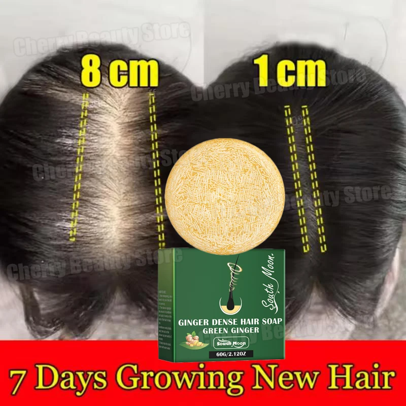 Ginger Hair Growth Soap Prevent Hair Loss Products Fast Growing Anti-Drying Scalp Treatment Repair Beauty Health Men Women