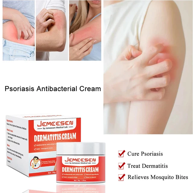 Psoriasis Antibakteriális Krém Dermatitis Ekzematoid Hatékony