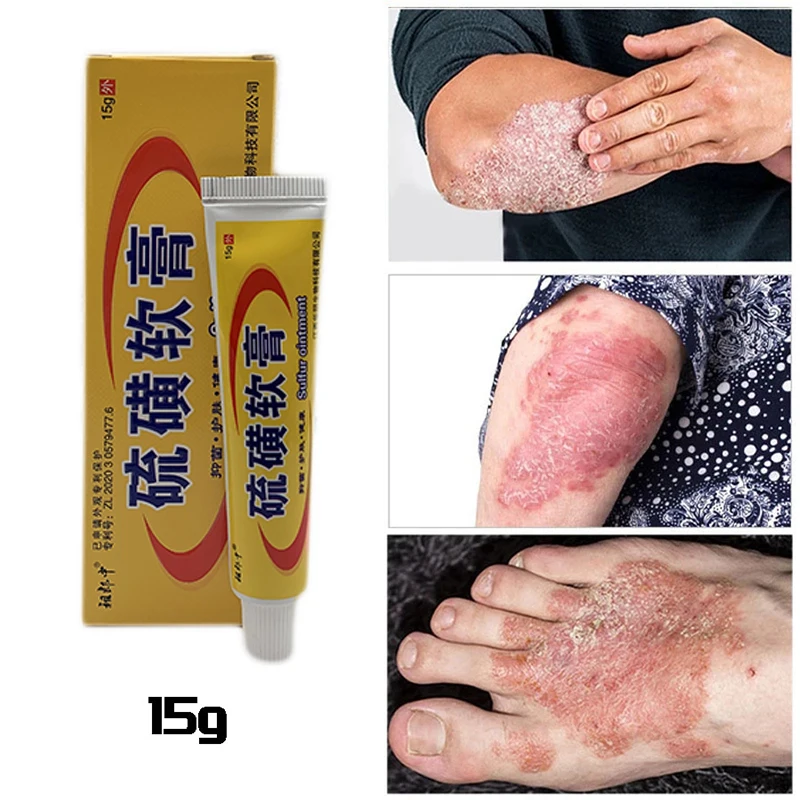 4 Types Sulfur Antibacterial Cream Scabies Repair Balm Eczema Ointment Dermatitis Antibacterial Herbal Formulas Health Care skin care ointment antibacterial anti fungal cream