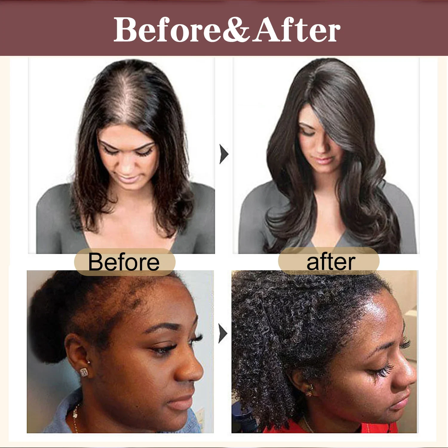 Hair Oil Organic Batana Oil For Hair Treatment
