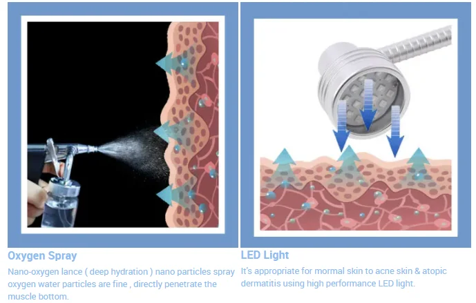 14 az 1-ben Hydrafacial bőrápoló gép – gyémánt dermabrázió és vízsugaras Aqua arckezelés SPA- és szépségszalonokhoz [Hydrafacial, dermabrázió]