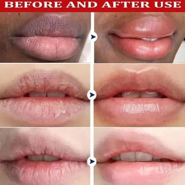 Fast Remove Dark Lip Balm Serum Lighten Melanin Lip Mask Exfoliating Fade Lip Lines Dead Skin Nourishing Repair Lip Care Makeup 2