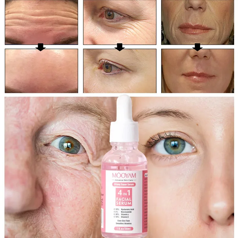 4 IN 1 Remove Wrinkles Face Serum Lifting Firming Fade Fine Lines Anti-Aging Essence Vitamin C Whitening Moist_voghion.com