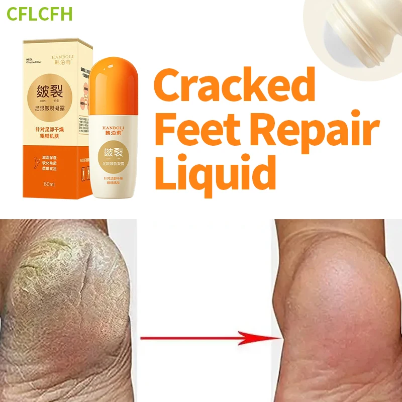 

Anti Crack Foot Cream Hand Dead Skin Removal Heel Chapped Drying Cracked Peeling Feet Repair Dew Moisturizing Care Foot Mask