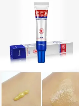 BIOAQUA Acne Removing Cream Acne Treatment Blackhead Removal Cream skincare Shrink Pores Anti-acne Creams Facial Skin Care - Thumbnail 8
