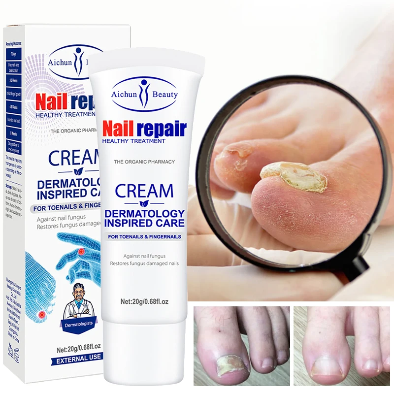 

Nail Treatment Feet Care Cream Nail Foot Whitening Toe Nail Fungus Removal Gel Anti Infection Paronychia Onychomycosis 20g