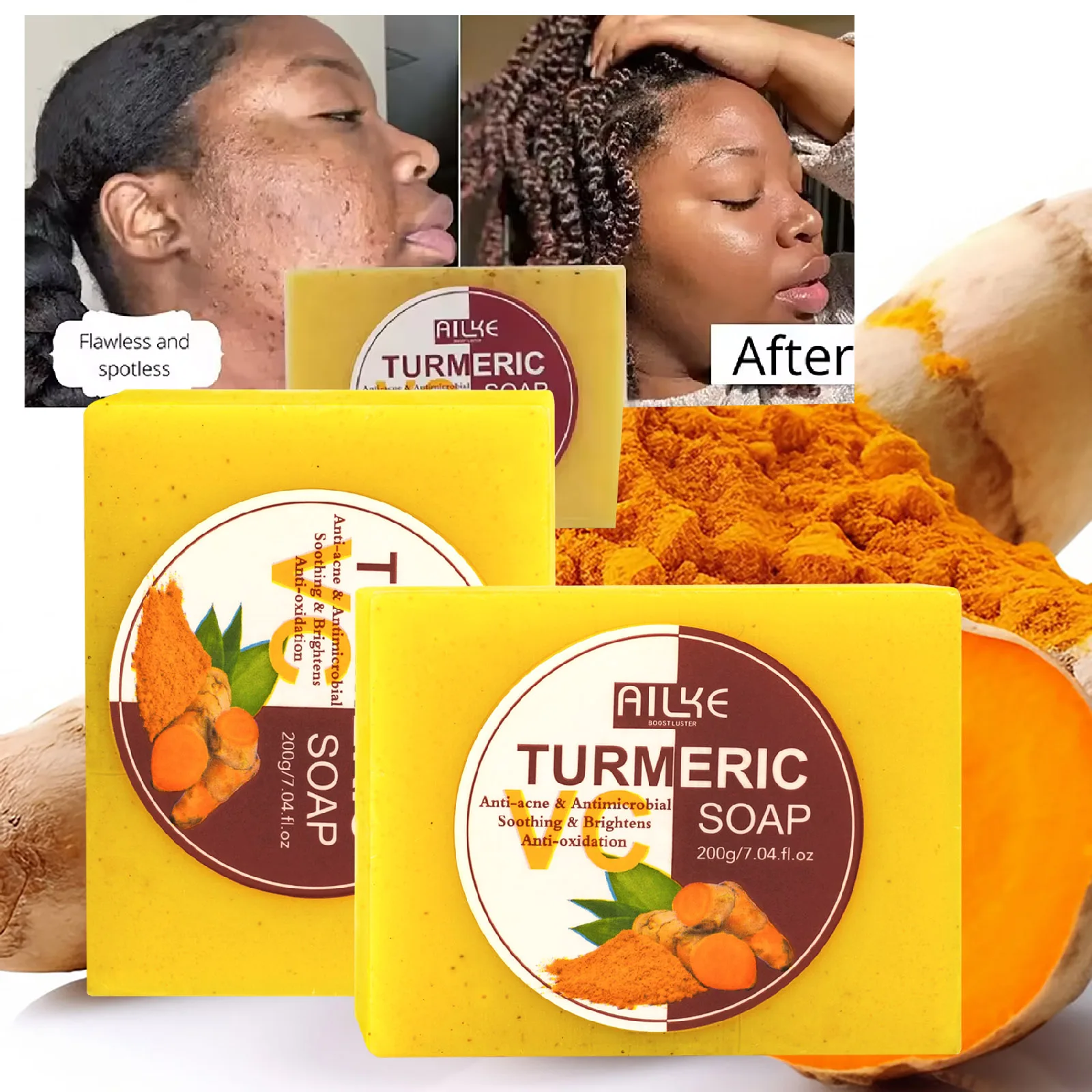AILKE Natural Turmeric Soap Bar, Brighten, Remove Darkness, Acne, Pimples, Cleaning, Exfoliates, Uneven Skin Tone, 200g