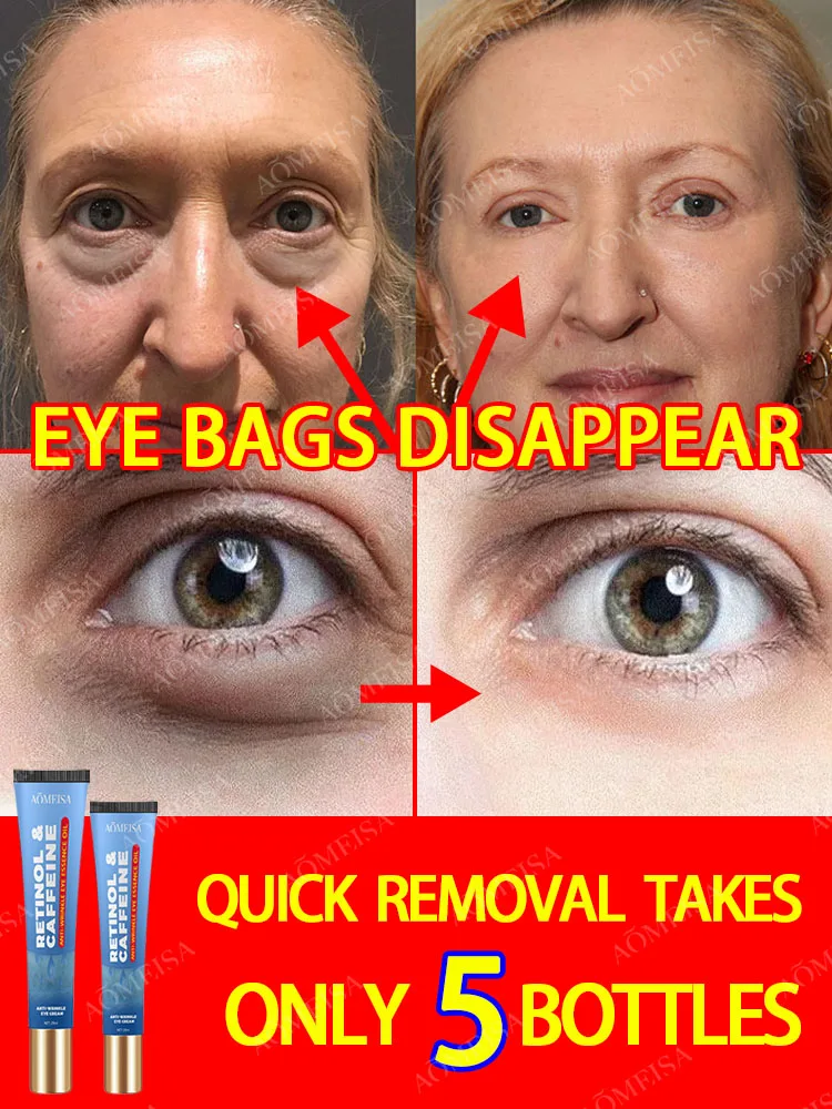 

Eye Care Anti-Wrinkle Eye Cream Dark Circles Remove Eye Bags Puffy Eyes Reduce Wrinkles Fine Lines Remover Eye Fat Particles