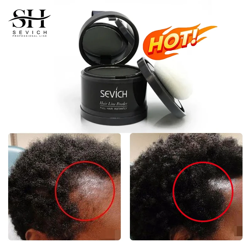 Sevich Waterproof Hair Line Powder 4G Natural Instant Hairline Shadow Powder Black Root Cover Up Fronte Hair Makeup Concealer
