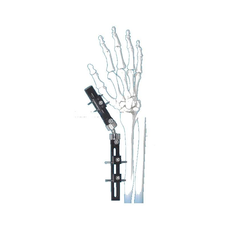 

Factory price high quality orthopedic wrist external fixation systerm