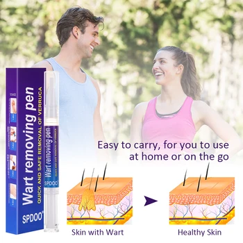 Removing Against Moles Remover Anti Verruca Remedy Liquid Pen Treatment Papillomas Removal Of Warts Liquid From Skin Tags 6