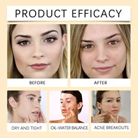 Centella soins du visage Combo démaquillant apaisant doux huile Centella nettoyant Centella sérum ensemble pour peaux sensibles soins quotidiens 5