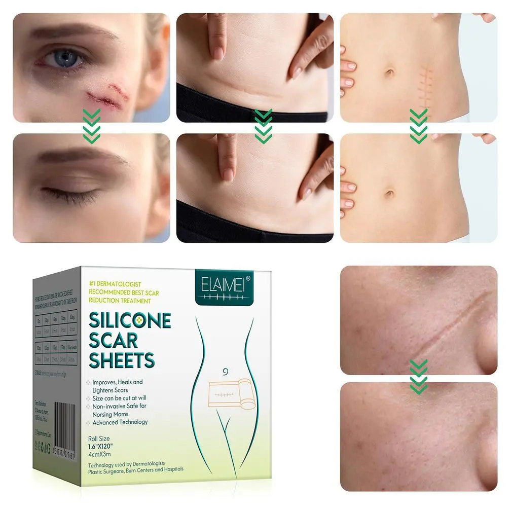 Pansement Silicone Cicatrice, Feuilles D'élimination des Cicatrices en  Silicone, Professionnelles Pour les Cicatrices Causées par la Césarienne,  la